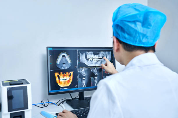 Best Emergency Treatment for Oral Infections in Rome, GA